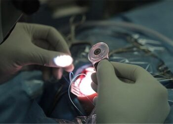 کاشت حلزون شنوایی برای ۲۰۳ نفر در استان فارس