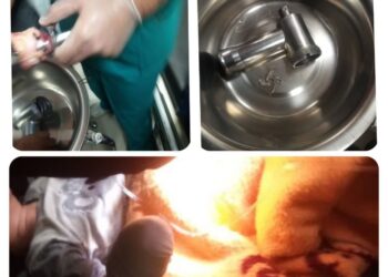 حادثه ای دلخراش بر اثر گیرکردن دست کودک در چرخ گوشت 2 حادثه ای دلخراش بر اثر گیرکردن دست کودک در چرخ گوشت